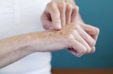 Mẹo chữa nám da tay bảo dưỡng làn da mướt mịn