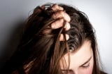 Tóc dầu có nên gội đầu hàng ngày không?