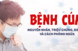 5 dấu hiệu cảnh báo bệnh cúm của bạn đang đi vào giai đoạn nặng dễ suy phổi: Chỉ 1/5 cũng phải đi khám