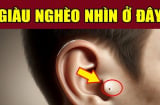 5 nốt ruồi giàu sang, ai sở hữu 1 cũng đủ phát tài may mắn hơn người