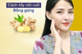 Tự tẩy nốt ruồi bằng gừng cực nhanh, an toàn và không để lại sẹo