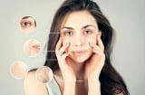 5 loại thực phẩm vừa tàn phá da vừa hại sức khỏe nàng nên hạn chế ăn