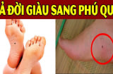 Nốt ruồi Thần Tài đánh dấu, giữ lại là phúc, xóa là mất lộc: Quanh bạn ai có không?