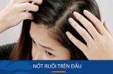 4 nốt ruồi vượng quý nhân, hậu vận giàu có vượt bậc