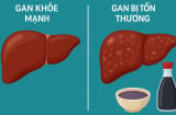 Cảnh báo: Loại gia vị quen thuộc này có thể âm thầm hại gan mà nhiều người Việt chưa biết