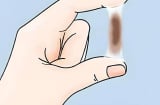 Chảy máu sau quan hệ – Cảnh báo ung thư cổ tử cung nhiều người chủ quan bỏ qua