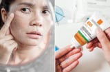 Sai lầm khi thoa kem chống nắng làm da sạm nám nhiều hơn