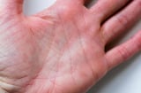 Tay có vân tam giác, giàu đến 90 tuổi: Bí ẩn đường chỉ tay hé lộ vận mệnh