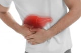 10 dấu hiệu cảnh báo bệnh Gan có thể nhận ra bằng mắt thường nhưng nhiều người chủ quan
