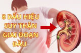 8 Dấu Hiệu Suy Thận Giai Đoạn Đầu: Phát hiện sớm cứu cả cuộc đời