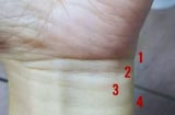 Nhìn vào 4 ngấn cổ tay: Biết ngay cuộc đời sung sướng Tiền Nhiều hay Nghèo Khổ