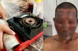 Bình gas mini phát nổ, 8 người nhập viện, lưu ý cách dùng để tránh họa bình gas mini