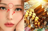 Người có 3 điểm này trên mặt Điềm Báo Phát Tài: Tiền vào như nước, thăng quan giàu có
