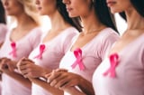 12 Yếu Tố Làm Tăng Nguy Cơ Mắc Ung Thư Vú: Phụ Nữ Nên Biết Để Phòng Ngừa Sớm