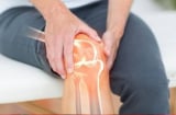 3 loại nước quen mặt nhưng âm thầm “rút sạch” canxi trong xương: Uống nhiều chỉ khiến xương giòn, dễ gãy