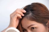 3 loại dinh dưỡng quan trọng này, nếu thiếu dễ khiến tóc bạn bạc sớm