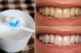 Đánh răng bằng thứ này, làm sạch mảng bám, tẩy trắng răng, không mòn men răng