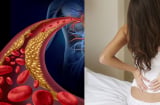 Người gầy vẫn bị mỡ máu cao vì những lý do này