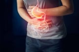 Ung thư dạ dày gia tăng nhanh chóng: 4 thói quen hàng ngày là 'thủ phạm giấu mặt'