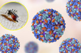 WHO cảnh báo nguy cơ bùng phát dịch do một loại virus, 5,6 tỷ người đứng trước mối nguy hiểm nhiễm bệnh