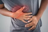 4 dấu hiệu cảnh báo bệnh gan sớm: Có 1/4 cũng nên đi kiểm tra sức khỏe sớm