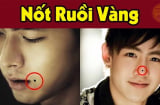4 nốt ruồi Vàng cực kỳ Hút Lộc: Ai có được giàu có 3 đời