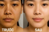 Rửa mặt bằng giấm gạo: Bí quyết làm đẹp 'ngon, bổ, rẻ' giúp da sáng căng, mờ mụn chỉ sau vài tuần