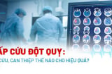 Cách sơ cứu đột quỵ tại nhà đúng cách nhất