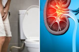 3 dấu hiệu vào ban đêm cảnh báo bệnh thận: Bỏ lỡ hối hận cả đời