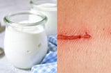 Nghiên cứu mới: Làm Gel trị thương từ sữa chua