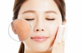 6 mẹo thu  lỗ chân lông như được “thu nhỏ”, giúp da trông mịn màng hơn