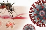 Bệnh Chikungunya đang có xu hướng bùng phát: Cảnh báo 2 nhóm người có nguy cơ mắc bệnh nặng hơn