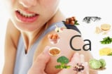 Top 3 nguyên nhân chính gây thiếu hụt canxi ở nữ giới