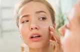 Điều gì khiến da khô điều trị mụn mãi không khỏi?