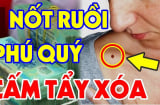 4 nốt ruồi Quý Hơn Vàng Mười, trời định có số giàu