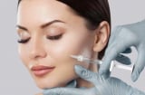 Những điều bạn nhất định phải biết trước và sau khi làm đẹp bằng phương pháp tiêm filler