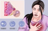 4 loại ung thư có tỷ lệ sống sót gần 100%, trong đó có ung thư vú – Đừng vội từ bỏ điều trị
