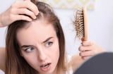 7 loại thực phẩm càng ăn nhiều càng giúp tóc chắc khỏe, giảm gãy rụng rõ rệt