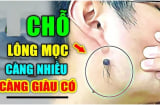 3 chỗ mọc lông Ngồi Không cũng có Tiền, số 1 nhiều người không biết lại nhổ đi