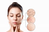 Nguyên tắc “sáng C – tối A” hồi sinh làn da nhiều khuyết điểm