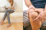 Ngồi vắt chéo chân lâu – thói quen tưởng vô hại nhưng tiềm ẩn 6 nguy cơ sức khỏe