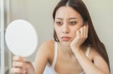 Chuyên gia bật mí tuyệt chiêu đỡ thâm và bọng mắt nhanh chóng