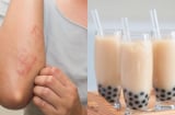 3 món ngọt âm thầm phá hủy lá gan, nhiều người Việt vẫn vô tư ăn hằng ngày