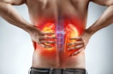 Người có thận yếu thường bị đau ở 5 chỗ: Số 1 nhiều người bị mà không biết
