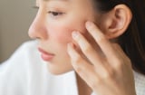 4 thói quen tưởng chừng vô hại nhưng lại khiến da dễ sạm nám