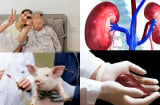 Ca ghép thận lợn đầu tiên ở châu Á sống hơn 200 ngày