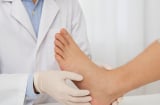 5 dấu hiệu ở bàn chân cảnh báo ung thư sớm: Nhìn tưởng nhỏ nhưng có thể cứu mạng bạn