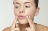5 cách tự nhiên giúp giảm nếp nhăn khi cười, lấy lại làn da tươi trẻ
