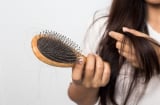 Mách nàng mẹo chăm sóc da đầu đúng cách trong mùa thu để ngăn ngừa rụng tóc