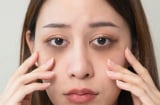 10 cách 'xóa sổ' quầng thâm mắt hiệu quả tại nhà, không cần mỹ phẩm đắt tiền hay ra spa